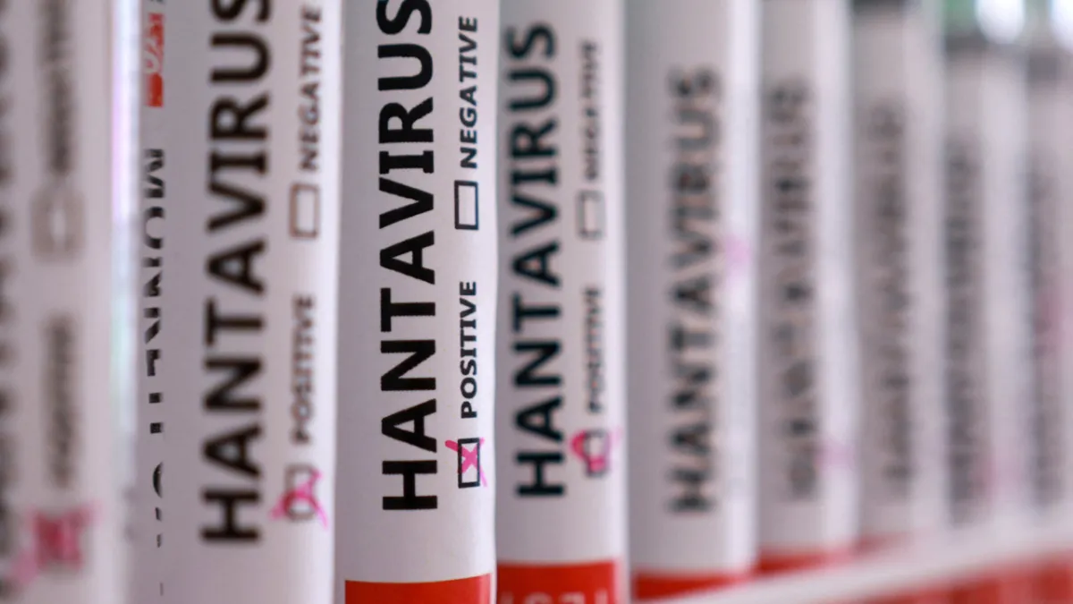 Hollanda'da hantavirüs alarmı büyüyor: Kan yanlış alındı, idrar doğru imha edilemedi